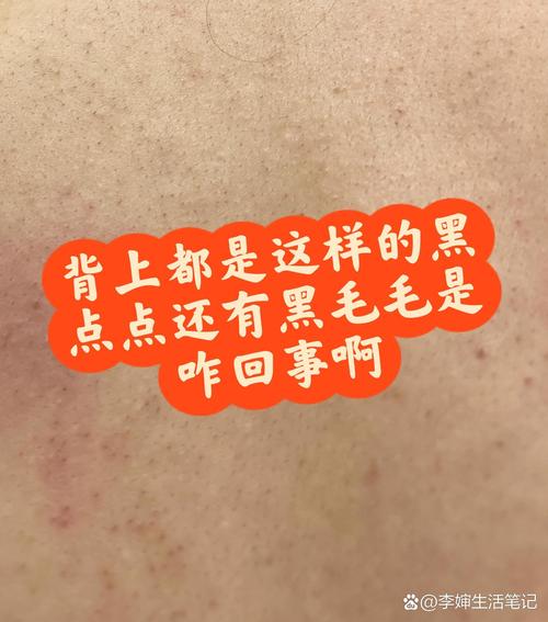 ...时买的.是纯黑色的.现在背上长出来的毛变成浅灰色的了.怎么回事啊...
