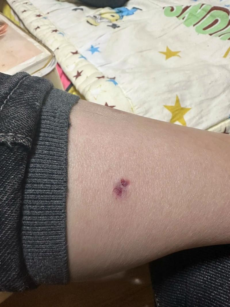 狗狗被蜈蚣咬了的症状