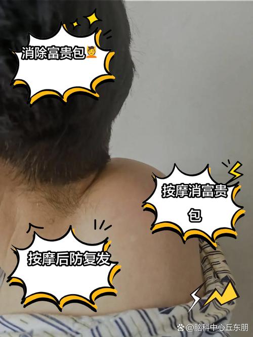 黄缘闭壳龟和安缘闭壳龟的区别